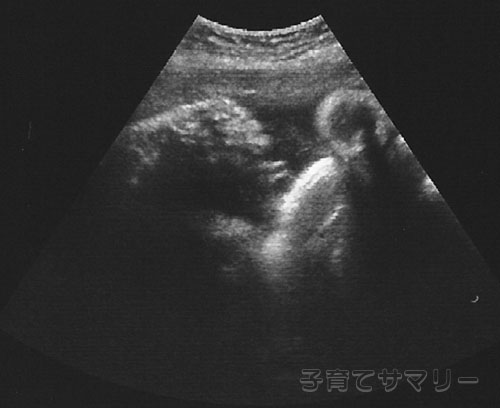 妊娠39週目の超音波写真1